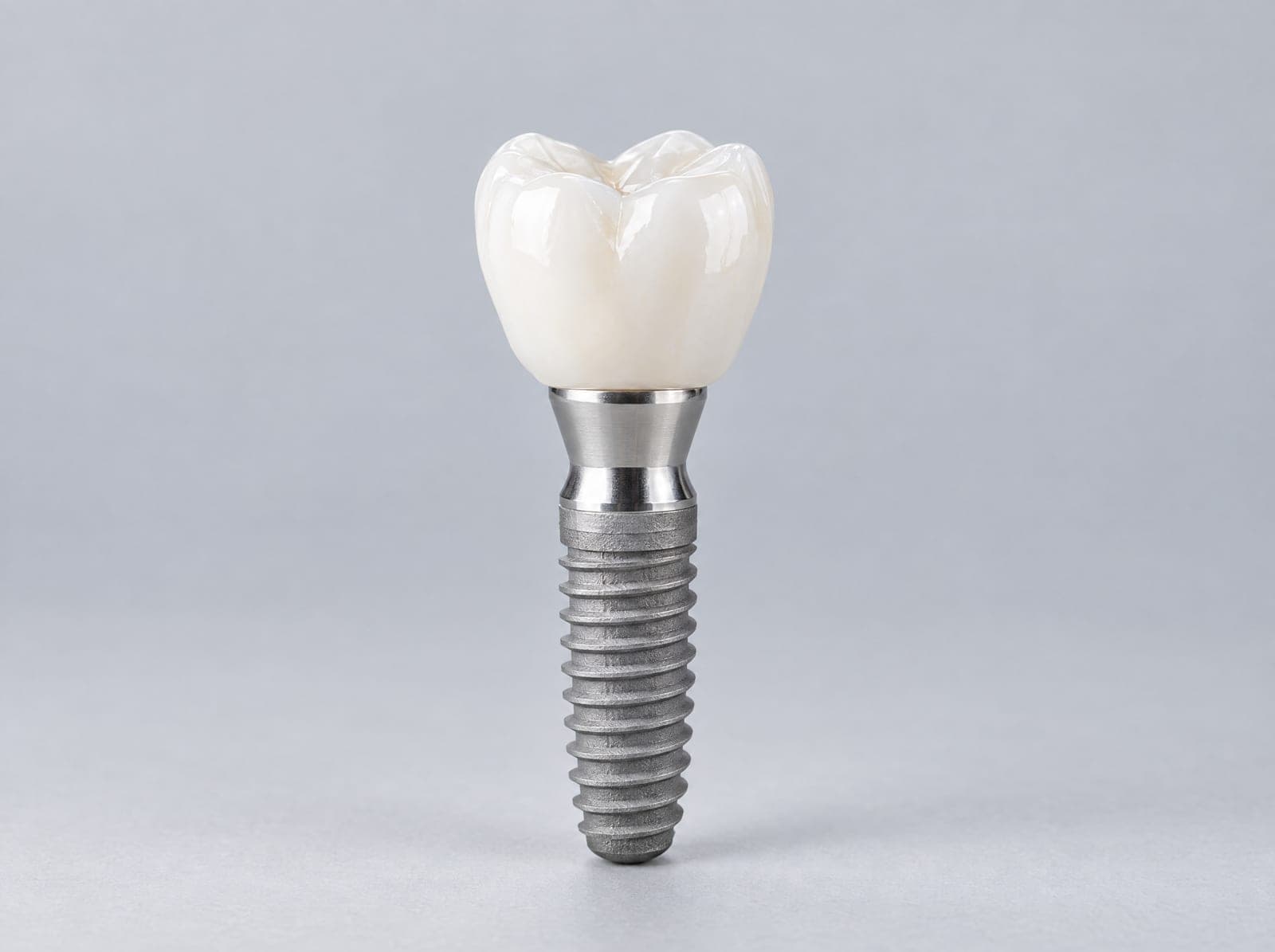 Illustrative image of a dental implant model: titanium post, abutment, and crown